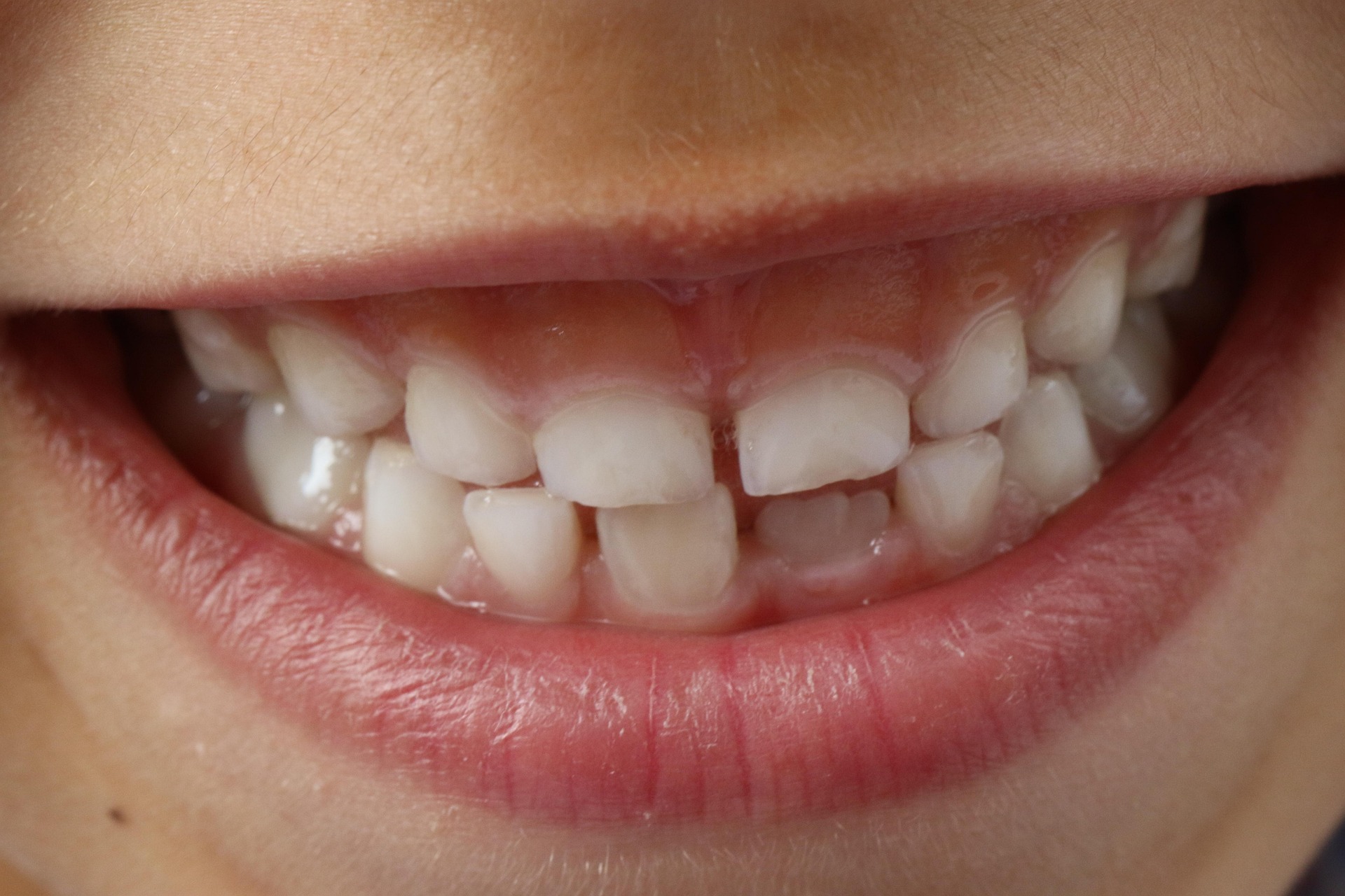 Soins pour enfants